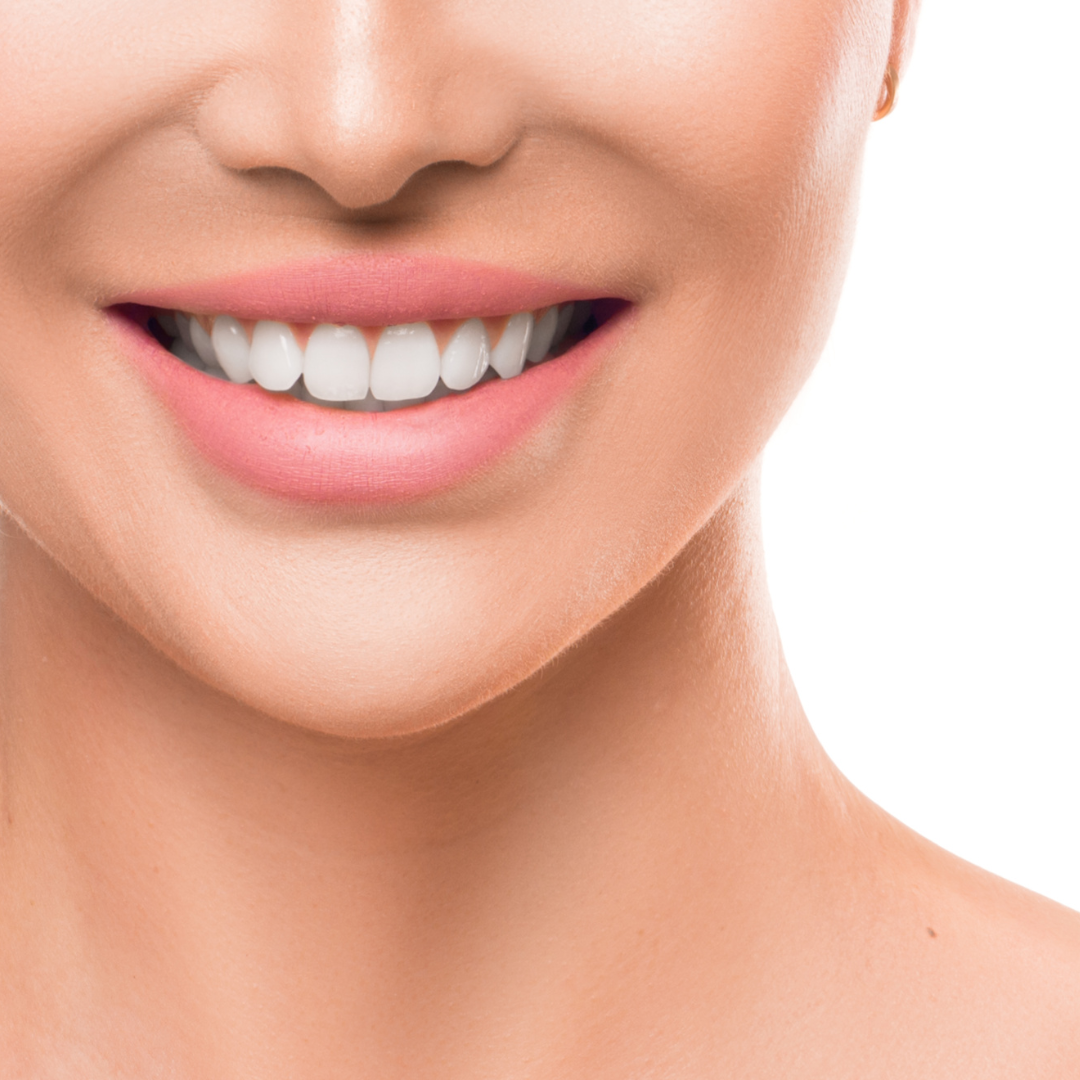 What are the requirements for dental implants?
